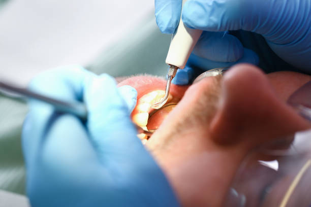 Best Weekend Emergency Dentist in Latimer, MS