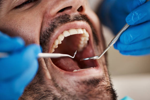 Best Urgent Care for Lost Fillings or Crowns in Latimer, MS